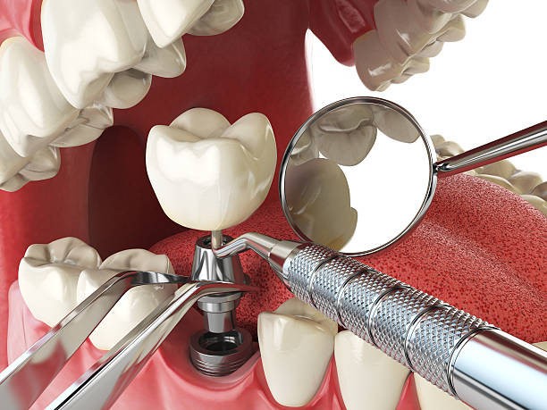 Best Emergency Orthodontic Repairs in Box Elder, SD
