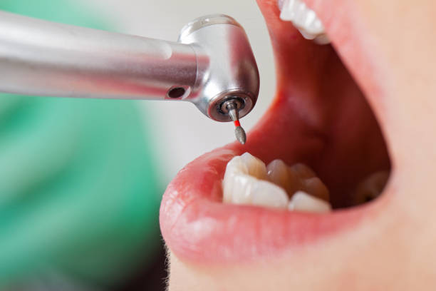 Best Emergency Broken Tooth Repair in Box Elder, SD